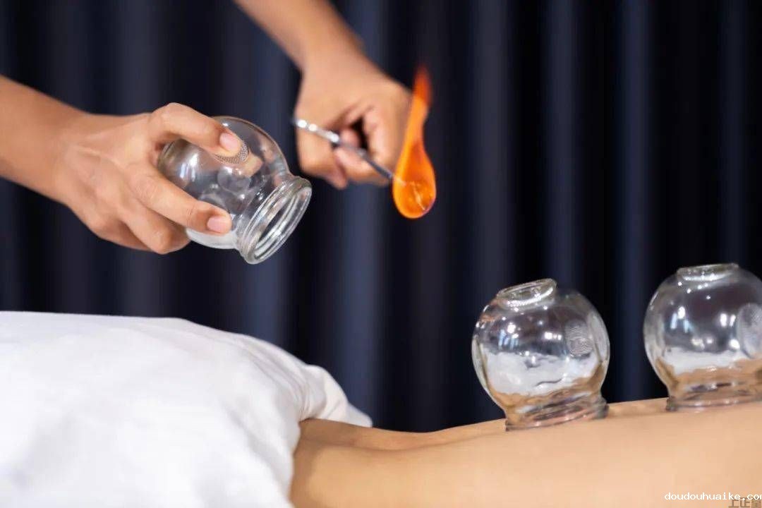 今日聚焦!湿气重拔罐有用吗